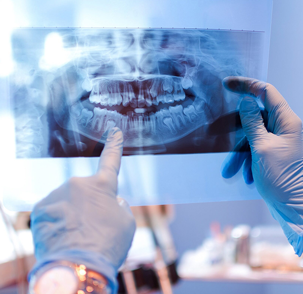 Dentist examining dental X-ray with gloved hands in professional clinical setting.