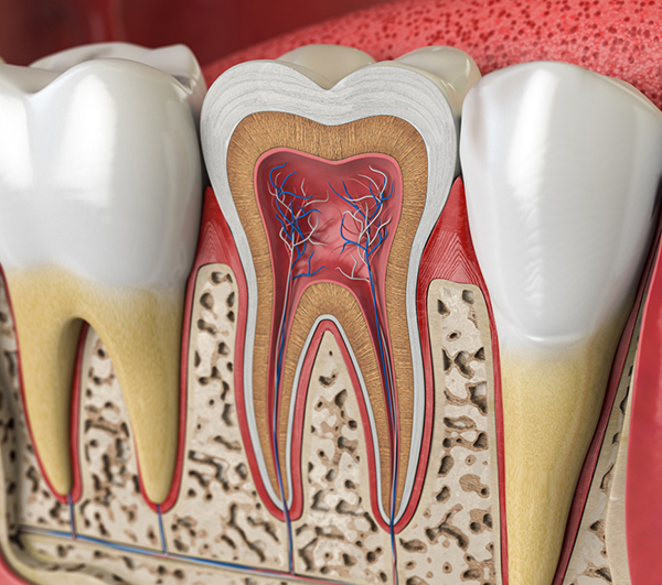 Dental cross-section model showing tooth structure with pulp chamber, roots, and surrounding bone tissue.